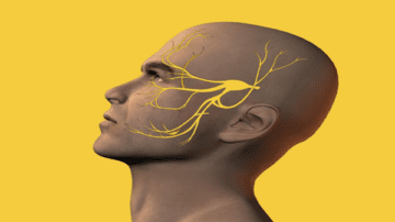 دوره تحریک عصب تری‌ژمینال